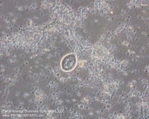 asb_stalked_ciliate1 | EBS